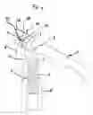 Fig. 04 - Movement-assisted corkscrew