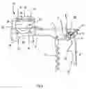 Fig. 07 - Movement-assisted corkscrew