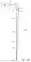 Fig. 19 - Customizable light bulb changer with suction cup and control