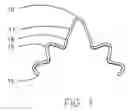 Fig. 02 - Guitar cord anchor