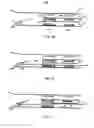 Fig. 08 - Devices and methods for raising and/or lowering a printing form