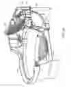 Fig. 16 - Feline exudate apparatus and method