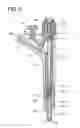 Fig. 03 - Fuel injection system