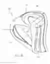 Fig. 26 - Full face respiratory mask with integrated nasal interface
