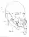 Fig. 27 - Full face respiratory mask with integrated nasal interface