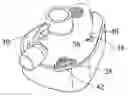 Fig. 01 - Pliant clip for attaching a strap to a mask