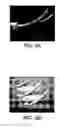 Fig. 11 - Vertically spaced plural microsprings