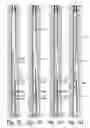 Fig. 03 - Thru tubing tool and method