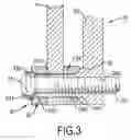 Fig. 04 - Adjusting device for positioning brake lining relative to a brake disk of a bicycle