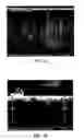 Fig. 05 - Deposition of LiCoO