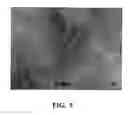 Fig. 05 - Nanoweb composite material and gelling method for preparing same