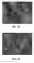 Fig. 06 - Nanoweb composite material and gelling method for preparing same