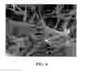 Fig. 08 - Nanoweb composite material and gelling method for preparing same
