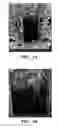Fig. 02 - Method for providing resistance to biofouling in a porous support