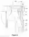 Fig. 07 - Trash container assembly