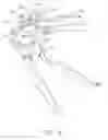 Fig. 05 - Rotary hydraulic pump actuated multi-stroke surgical instrument
