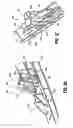 Fig. 16 - Surgical fastener applying apparatus