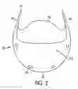 Fig. 03 - Removable mouse palm rest