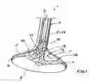 Fig. 02 - Method of manufacturing a lightweight valve