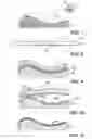 Fig. 04 - Bifurcated contact printing technique