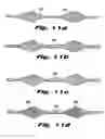 Fig. 06 - Temporary vascular filter guide wire