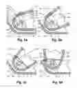 Fig. 07 - Boot for a binding