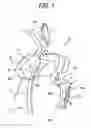 Fig. 02 - Occupant restraint device and occupant restraint system