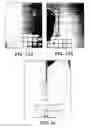 Fig. 15 - Stereoscopic wide field of view imaging system