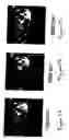 Fig. 06 - Method for correlating spectroscopic measurements with digital images of contrast enhanced tissue