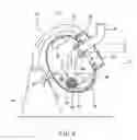 Fig. 08 - Powder and particle processing apparatus and baffle device
