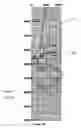 Fig. 06 - Method and apparatus for detecting overpressured zone ahead of a drill bit using resistivity and seismic measurements