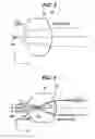 Fig. 03 - Micro lens array and its manufacturing method