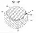 Fig. 04 - Prevention of static bonding between medical device components