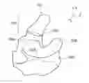 Fig. 01 - Method and apparatus for the classification of surface features of an ear impression