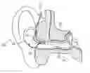 Fig. 01 - Tinnitus treatment device