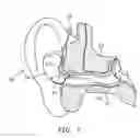 Fig. 05 - Tinnitus treatment device