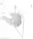 Fig. 03 - Method and apparatus for ear canal surface modeling using optical coherence tomography imaging