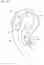 Fig. 03 - Behind-The-Ear-Auditory Device