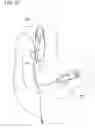 Fig. 05 - Behind-The-Ear-Auditory Device