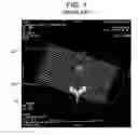 Fig. 02 - System and method for 3D graphical prescription of a medical imaging volume