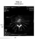Fig. 03 - System and method for 3D graphical prescription of a medical imaging volume
