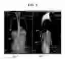 Fig. 04 - System and method for 3D graphical prescription of a medical imaging volume
