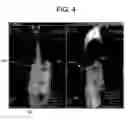 Fig. 05 - System and method for 3D graphical prescription of a medical imaging volume