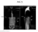 Fig. 06 - System and method for 3D graphical prescription of a medical imaging volume