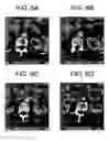 Fig. 07 - System and method for 3D graphical prescription of a medical imaging volume