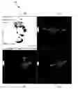 Fig. 01 - System and method for automatically assessing active lesions