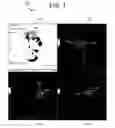 Fig. 02 - System and method for automatically assessing active lesions