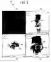 Fig. 04 - System and method for automatically assessing active lesions