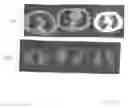Fig. 13 - Method and system for automatic lung segmentation