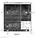 Fig. 04 - Method and apparatus of processing a time-sequence of separate image data sets